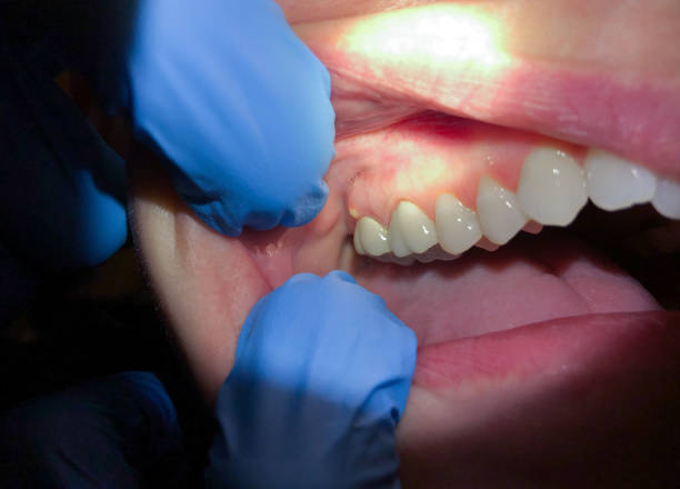 Best Pediatric Emergency Dentist in Claxton, GA