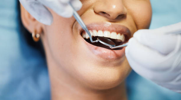 Best Emergency Root Canal Treatment in Claxton, GA
